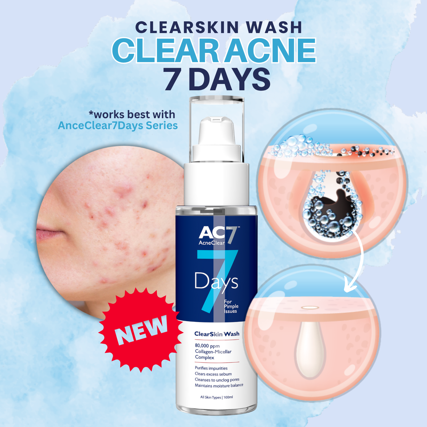 AcneClear 7 Days ClearSkin Wash