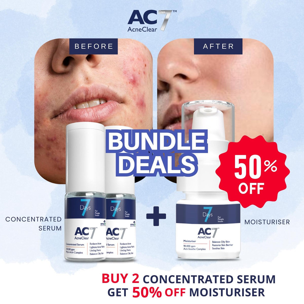 AcneClear7 Days Two Serums + Moisturiser (50% Off)