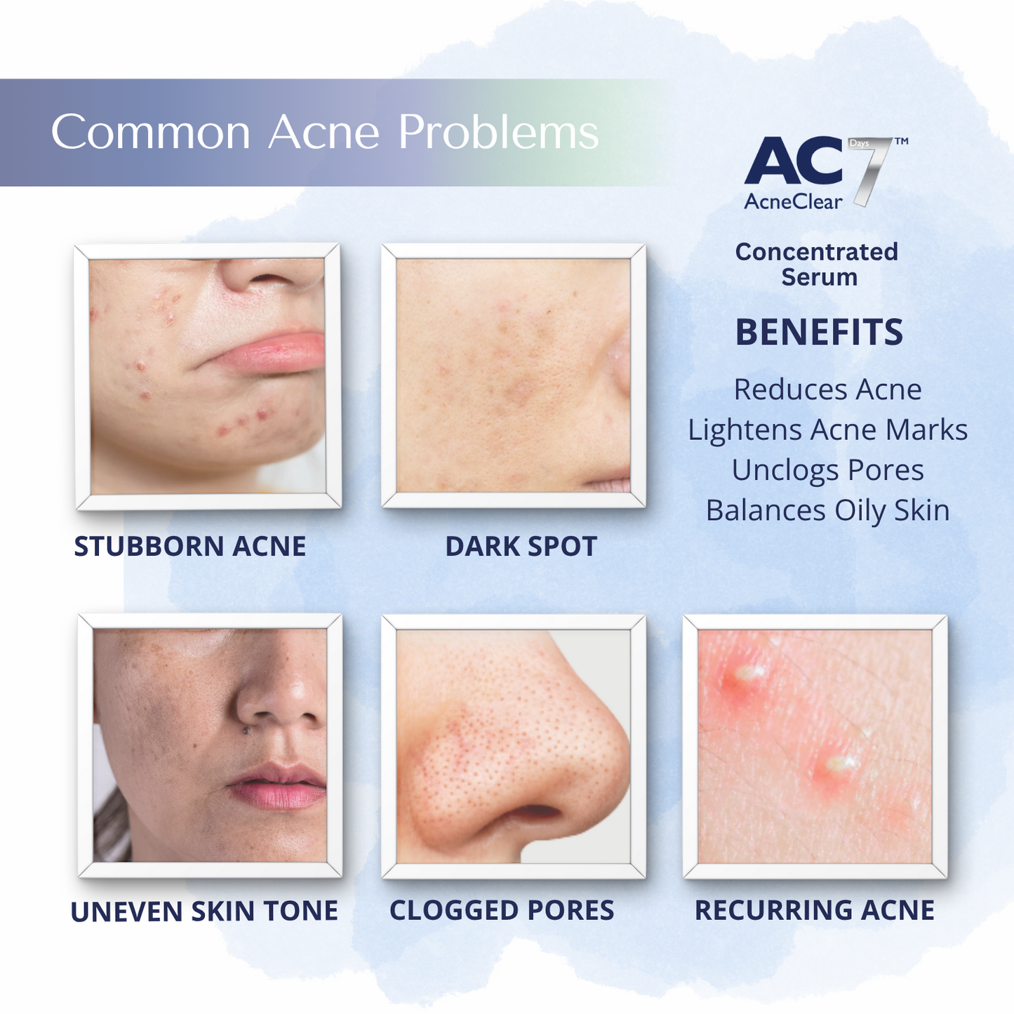 AcneClear7 Days Two Serums + Moisturiser (50% Off)