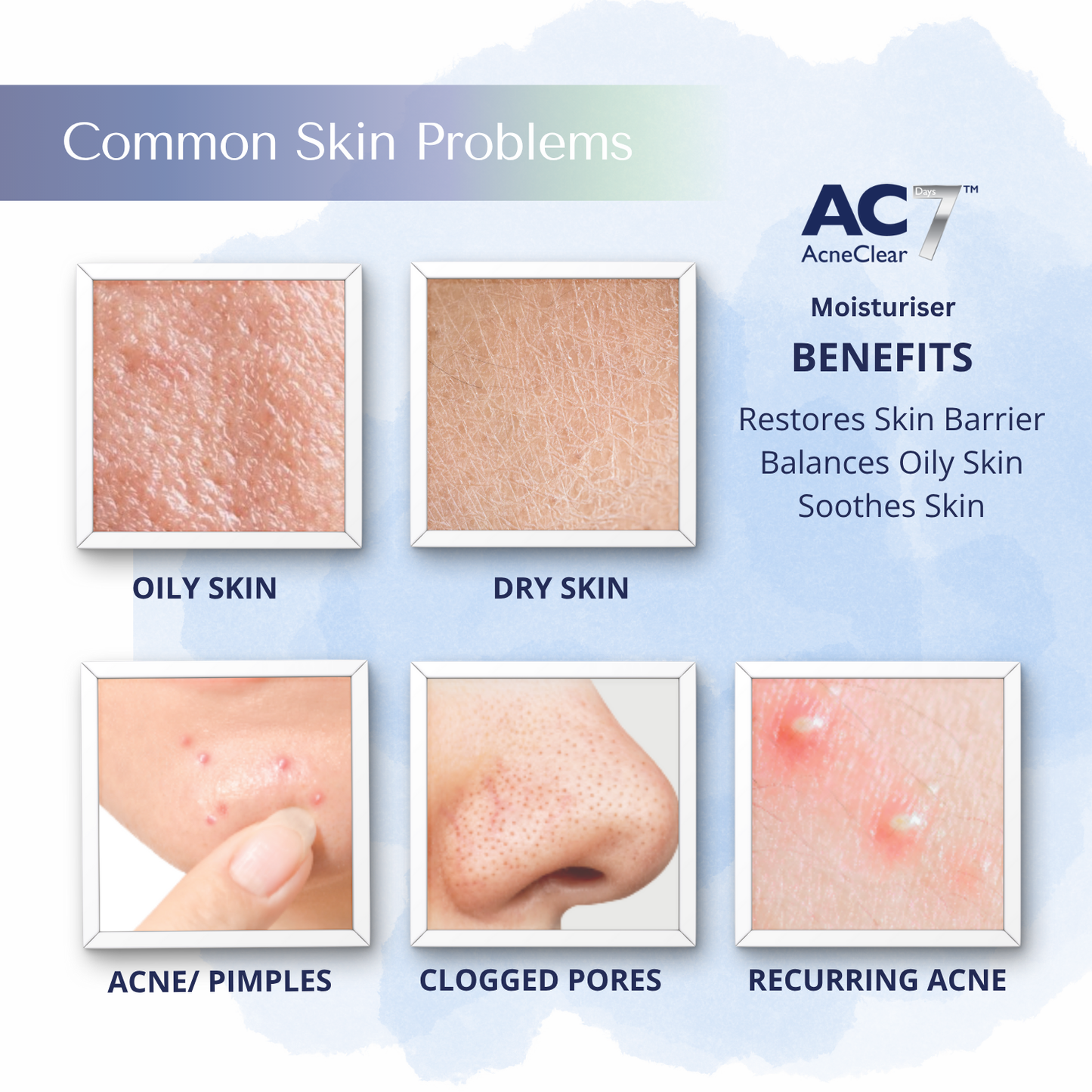 AcneClear7 Days Two Serums + Moisturiser (50% Off)