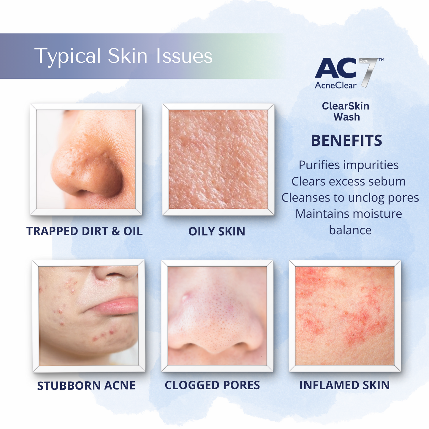 AcneClear 7 Days ClearSkin Wash