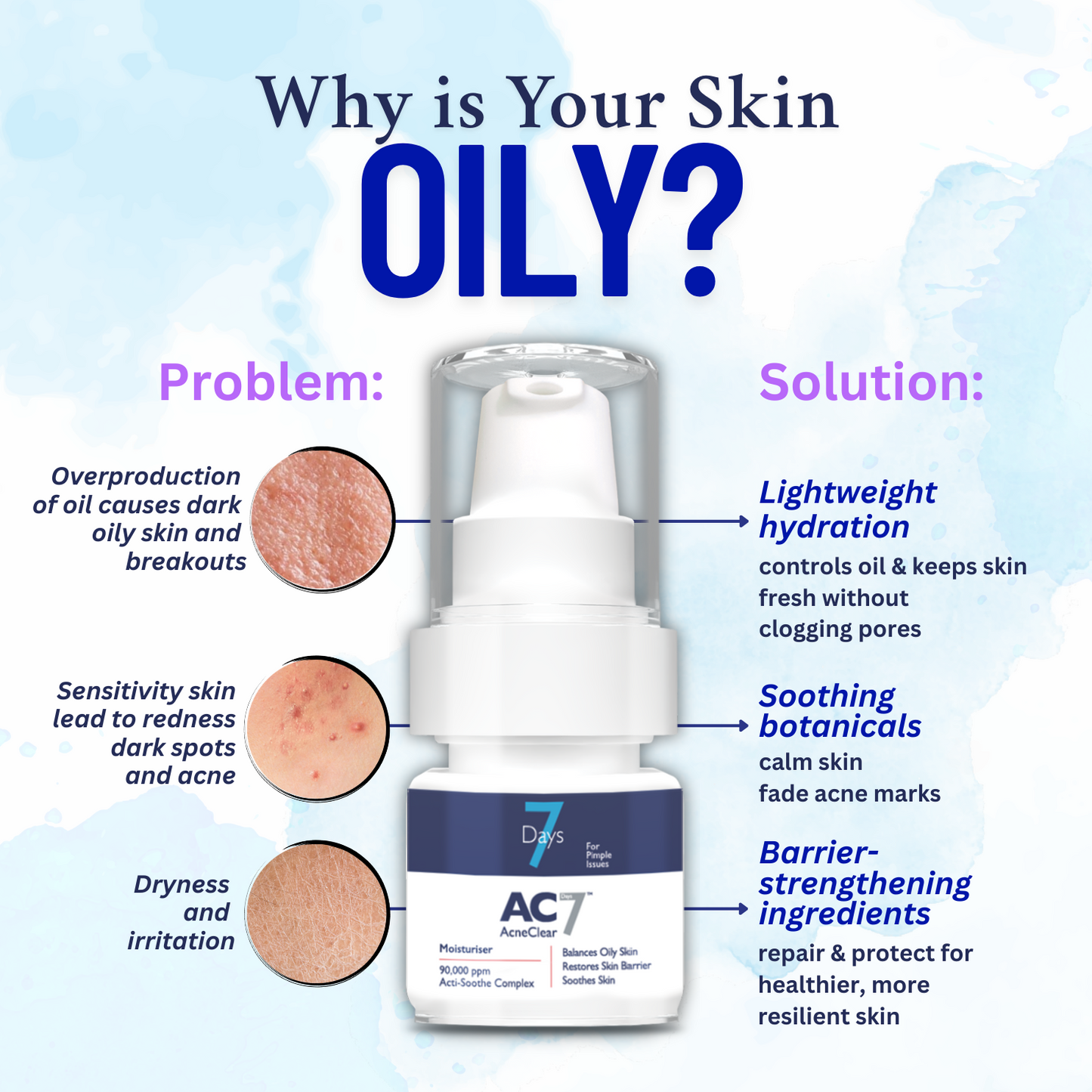 AcneClear7 Days Two Serums + Moisturiser (50% Off)