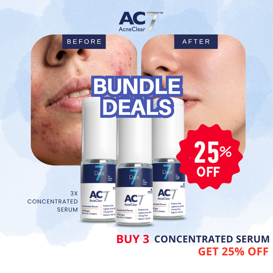 AcneClear7 Days Concentrated Serum (Bundle of 3)