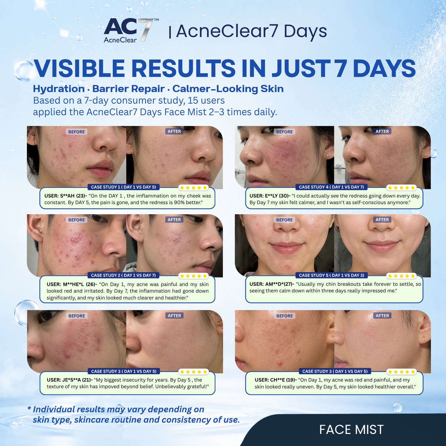 AC7D Face Mist 50ml - Oil Control & Acne Relief Spray