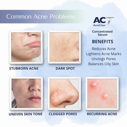 2x AC7D Acne Care Starter Kit (2xSerum 10ml + 2xMoisturiser 30ml)
