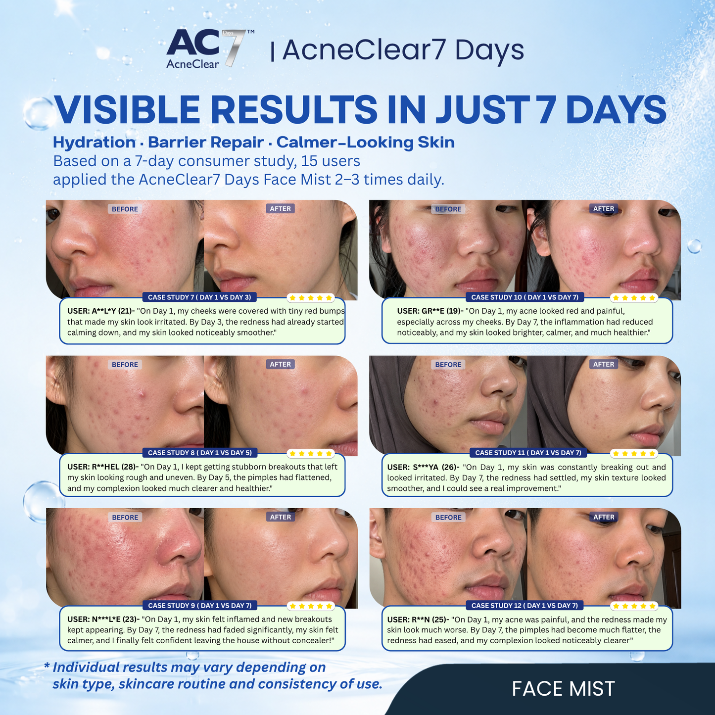 AC7D Face Mist 50ml - Oil Control & Acne Relief Spray