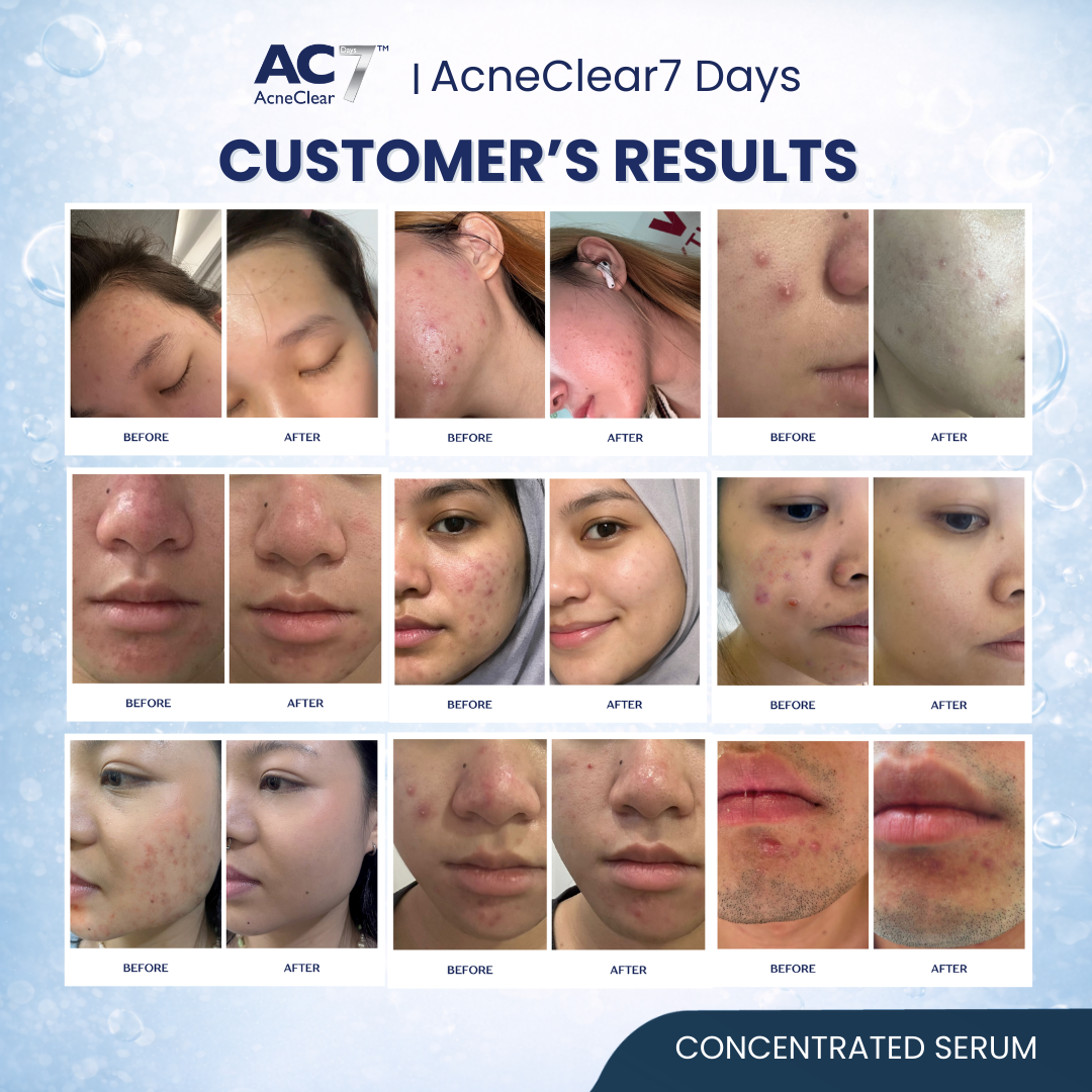AC7D Serum Concentrated 10ml (Low Stock)