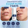 AcneClear7 Days Concentrated Serum